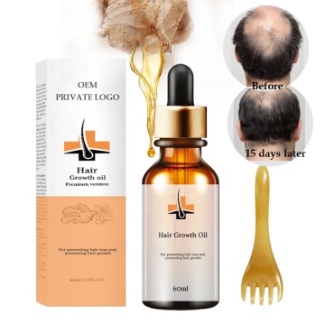 Laser Hair Growth Products and Natural Oils for Men and Women