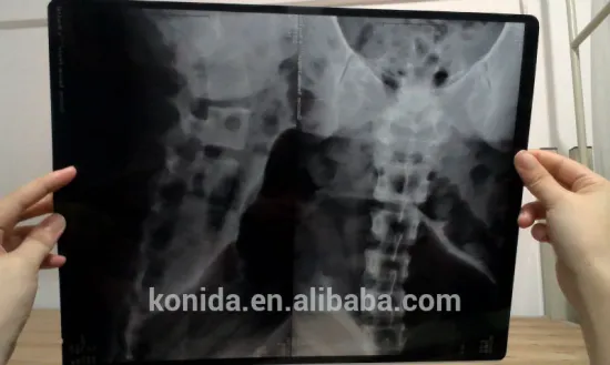 china film type Agfa x-ray film drystar dt2b mri scanner machine alibaba express