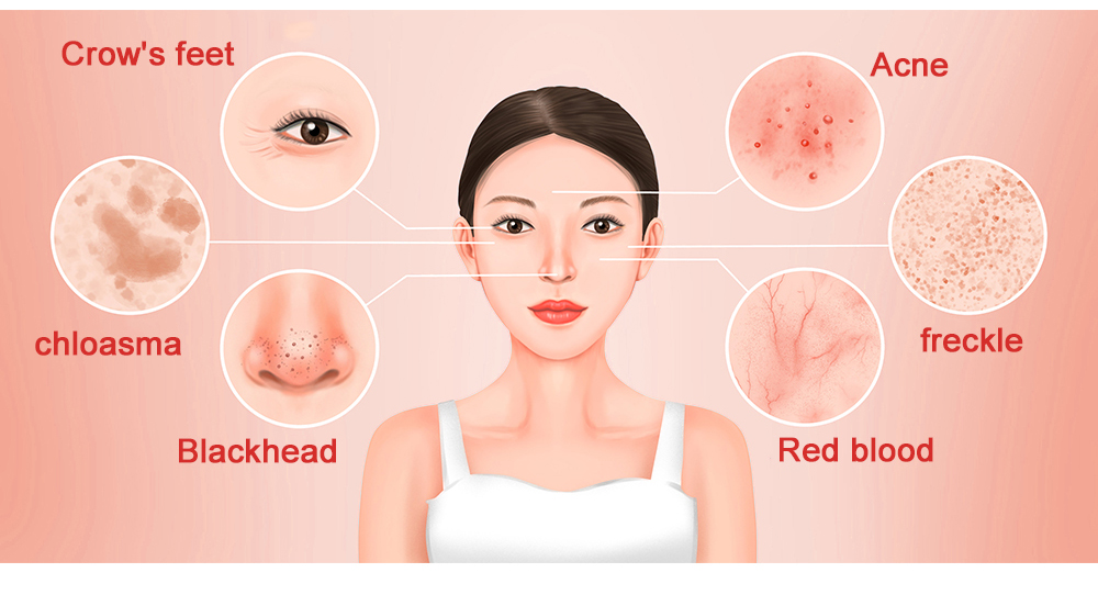 Facial Light Therapy