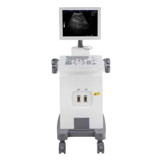 High-Quality Portable Ultrasound Machine with Basic Trolley: An Essential Hospital Equipment for Human Scanning