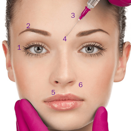 Face Moisture Anti Wrinkle Filling PLLA Fillers