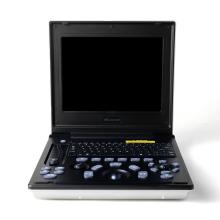 Жаночы ўльтрагукавы дыягнастычны інструмент CHD