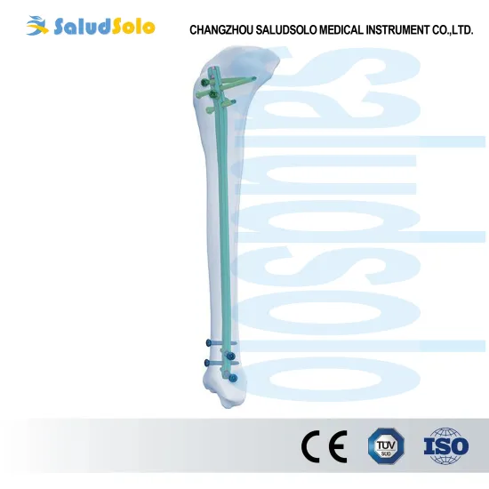 Medical Expert Tibia Nail
