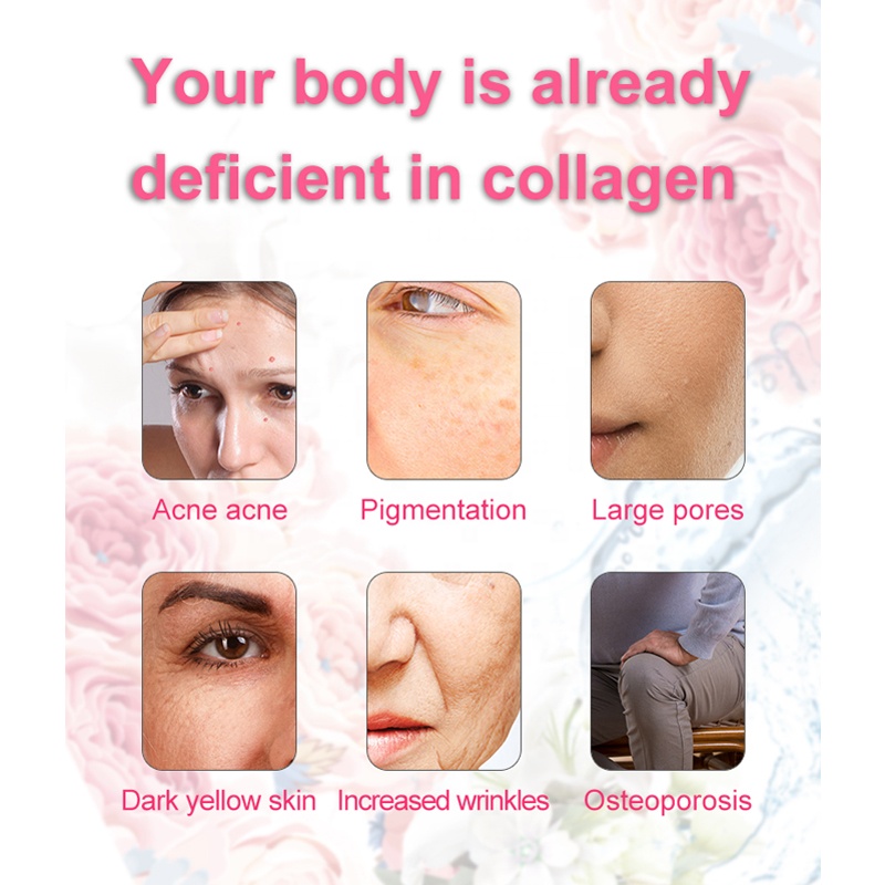 OEM/ODM Marine collagen peptide Jelly Stick Collagen Jelly Stick Collagen Jelly Stick3