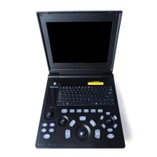 Дзеці кардыяміяпатыя ўльтрагукавога дыягнастычнага інструмента