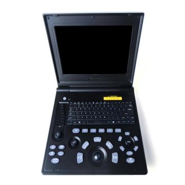 Дзеці селязёнкі тромба ўльтрагукавога дыягнастычнага інструмента