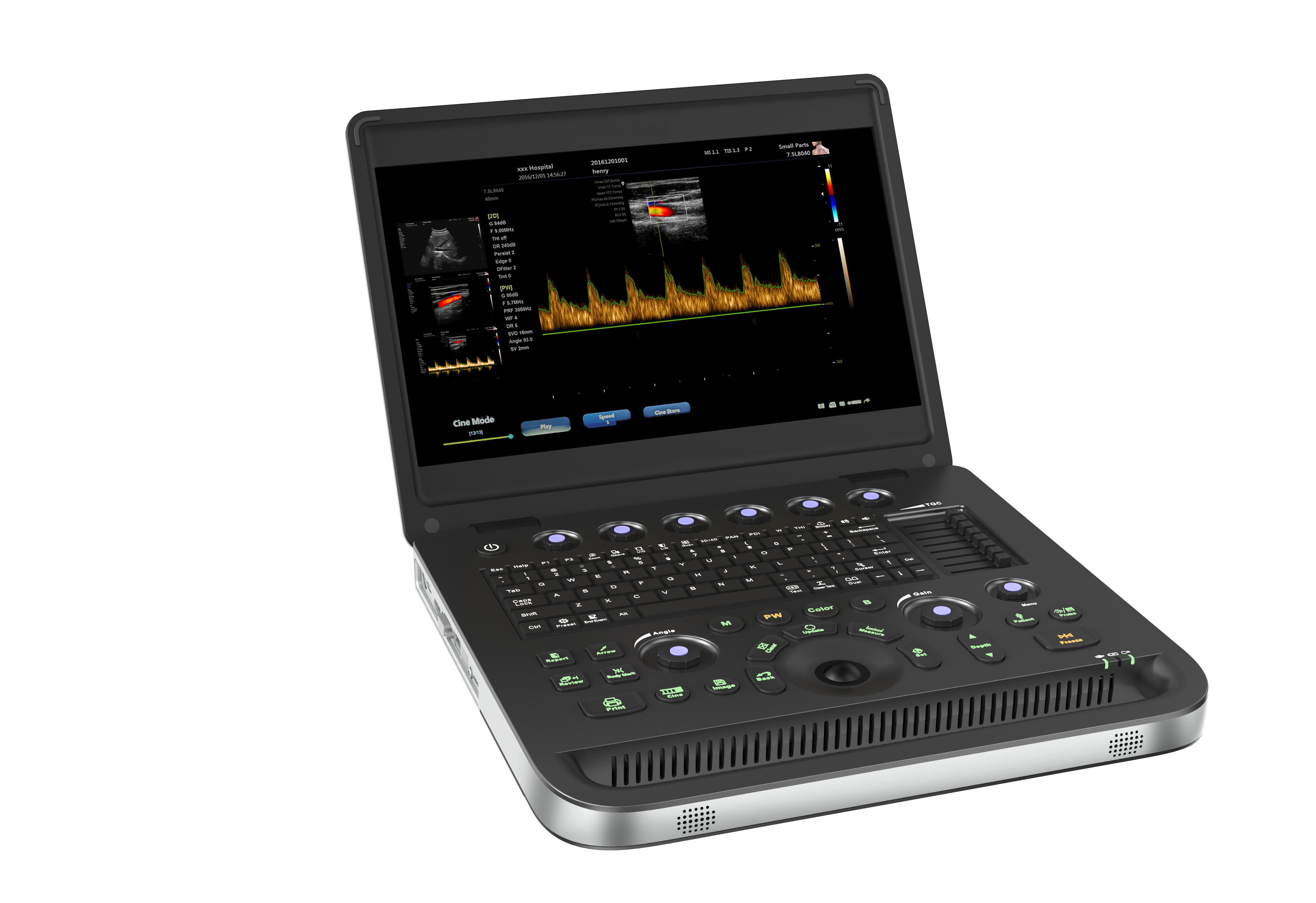 Peralatan Ultrasonik Doppler untuk Organ Sistem Urin