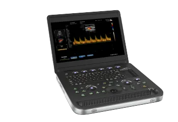 Children polycystic kidney ultrasound diagnostic instrument