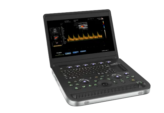 Doppler ultrasound equipment for urinary system organs
