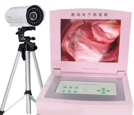 Digital Electronic Video Colposcope with High Quality