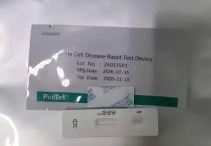 Sickle Cell Disease Rapid Test Device