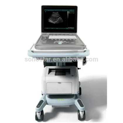 Sonostar Ultrasonic Diagnostic Devices Digital Portable Ultrasound Machine Price SS-9