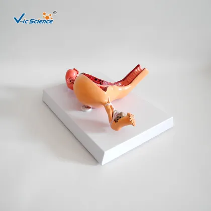 Pathological Uterine Anatomy Education Model