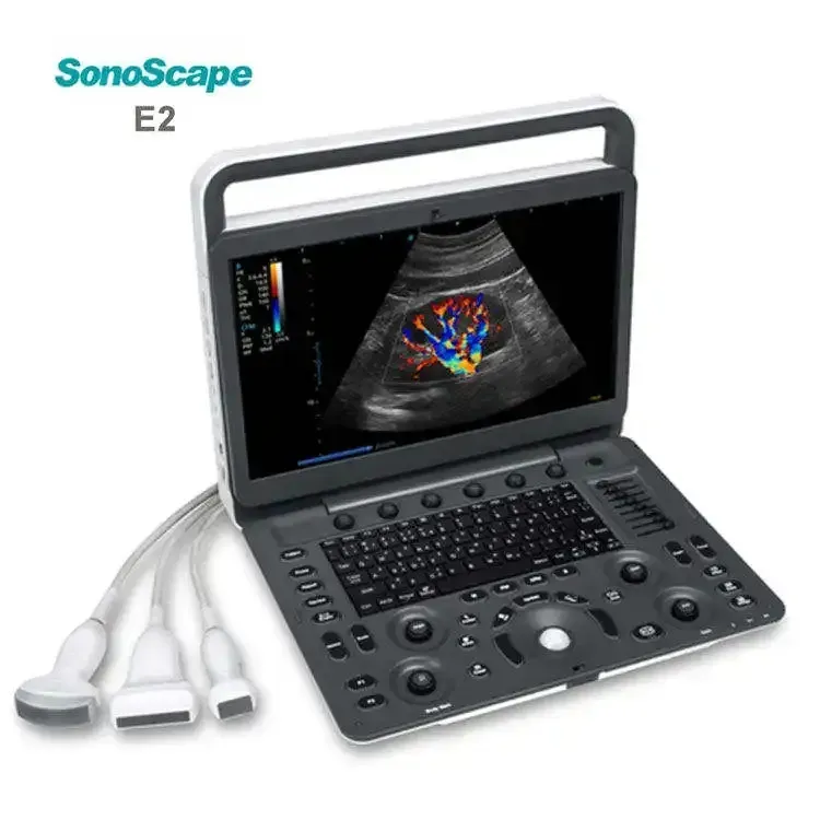 Sonoscape E1 Portable Animal Ultrasound