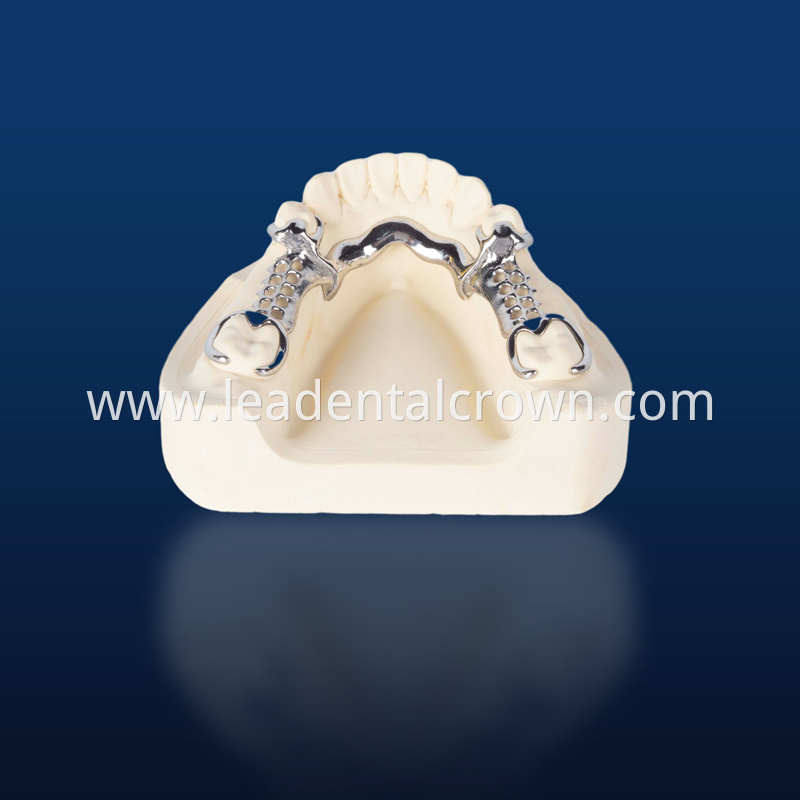 Offer Detachable Metal Framework Partial Bridge From China
