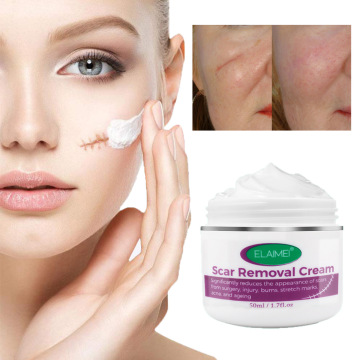 Crema profesional de tratamiento de cicatriz y acné: combatir cicatrices profundas, espinillas, acné, estrías y más