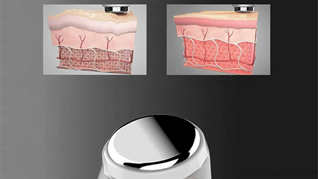 Ultrasonic Transducer for Beauty Devices