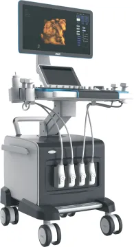 Trolley High Focused Color Doppler Medical Ultrasound