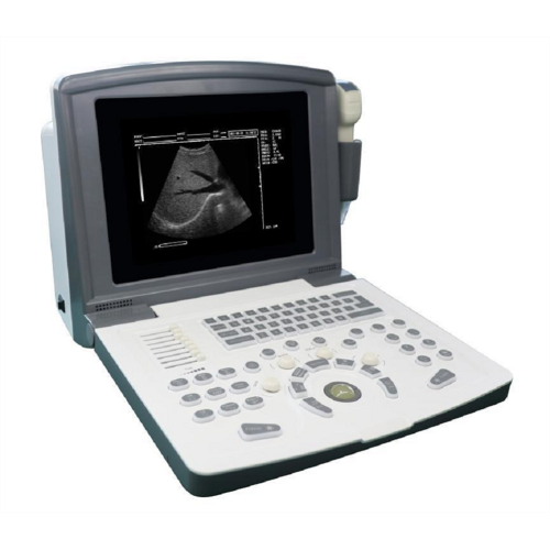 Portable Black And White Ultrasound Scanner for Obstetrics