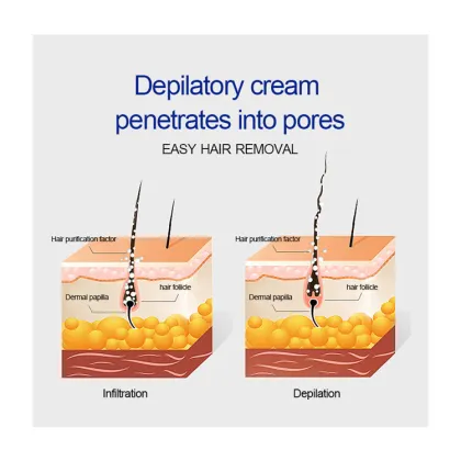 Aloe Vera Acne & Hair Removal Cream - Permanent Hair Removal for Women