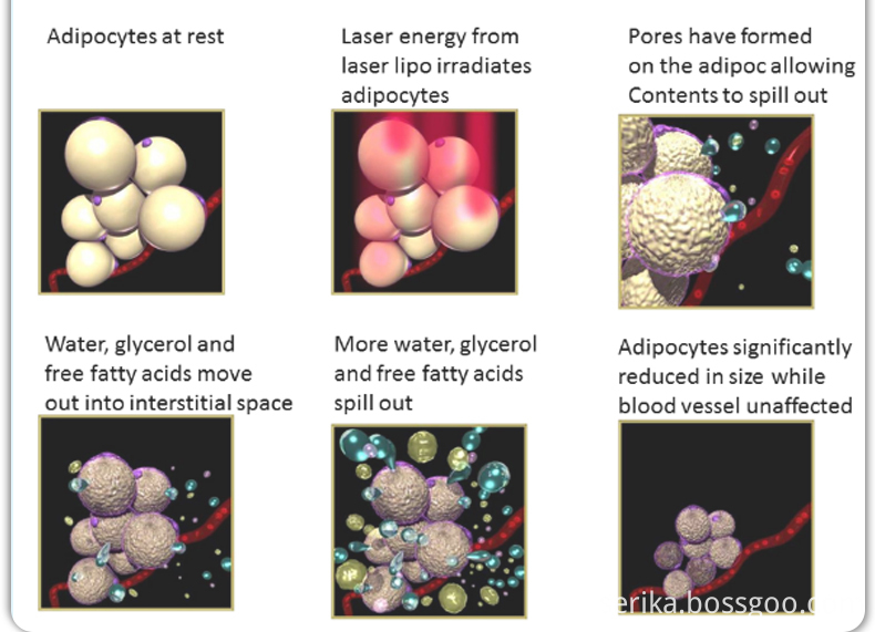 Cryolipolysis Price