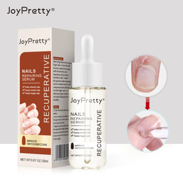 Joypretty Anti-Fungal Nail Treatment Oil: Moisturizing, Lustrous Nail Care and Repair Serum for Toenail Fungus