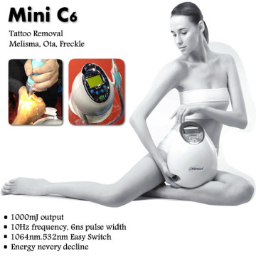 ND YAG Q Switched Laser Tattoo Removal