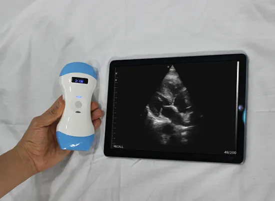 Economic Portable Full Digital Ultrasound Scanner