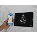 Economic Portable Full Digital Ultrasound Scanner