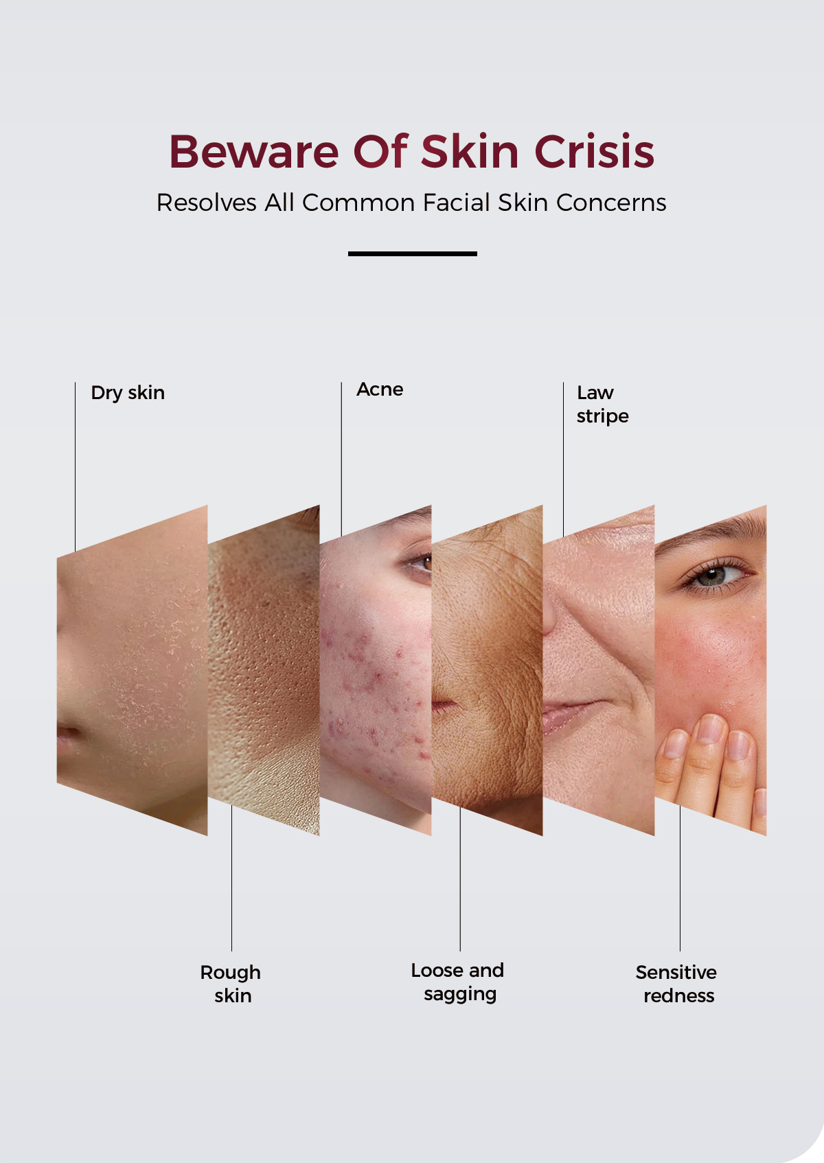 facial device for wrinkles