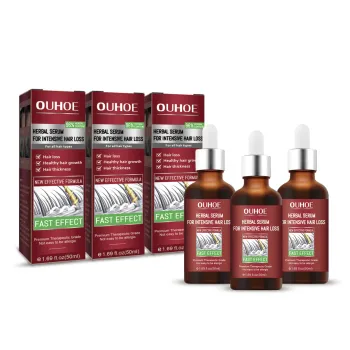 OUHOE Close Serum: Moisturizes Roots, Prevents Hair Loss, and Strengthens Hair Conditioning Essence