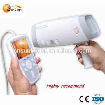 2015 hot selling vaginal colposcope price