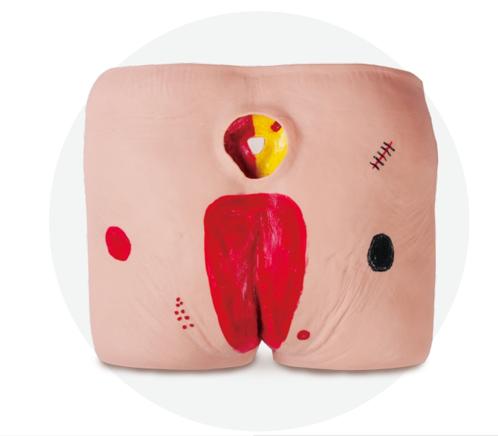 Decubitus Care Training Model