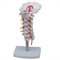 Spine cervicale avec artère carotide et modèle nerveux