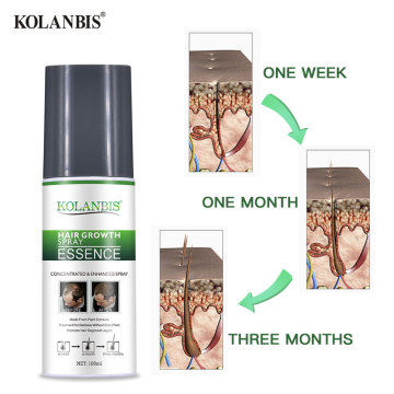 Organic Hair Loss Product for Men and Women: Hair Regrowth Oil