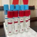 Одноразовый сосуд для сбора крови с цитратом натрия