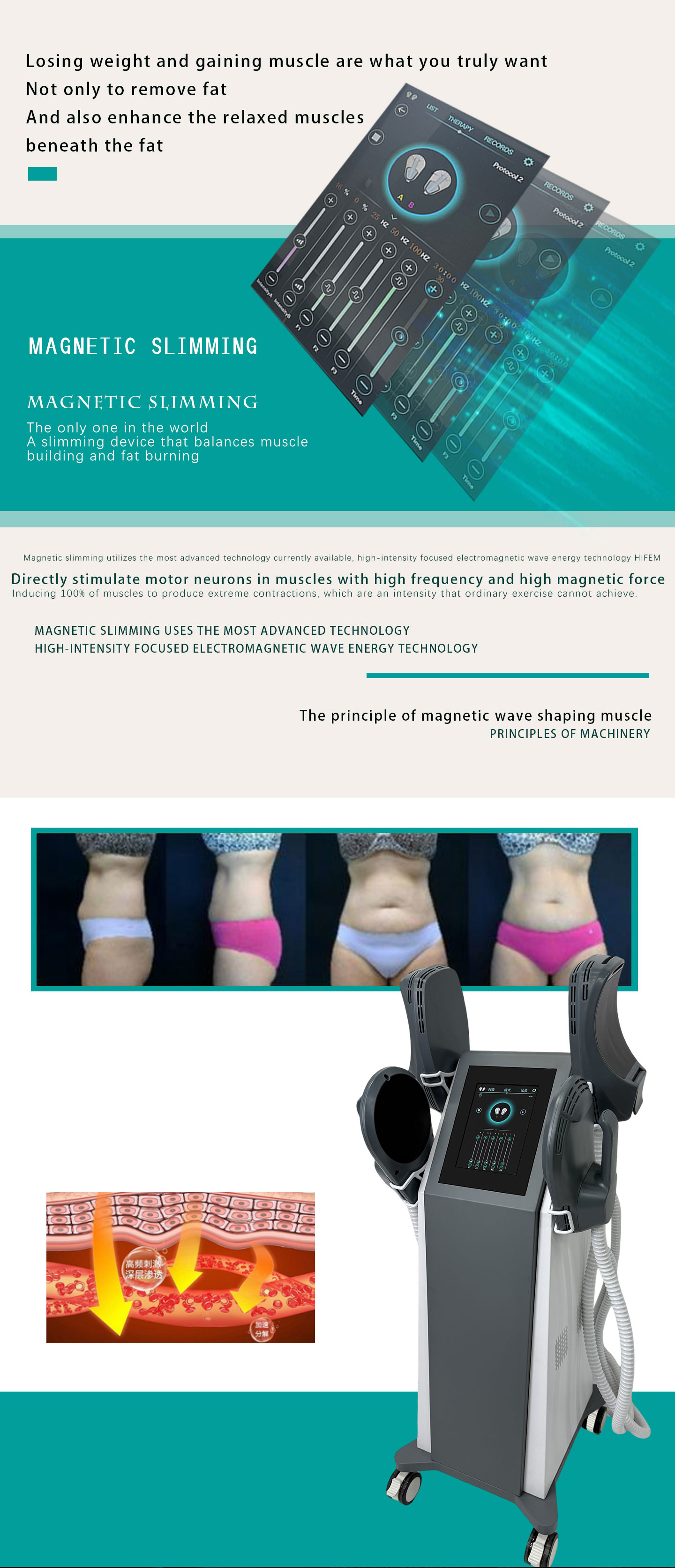 buy emsculpt machine