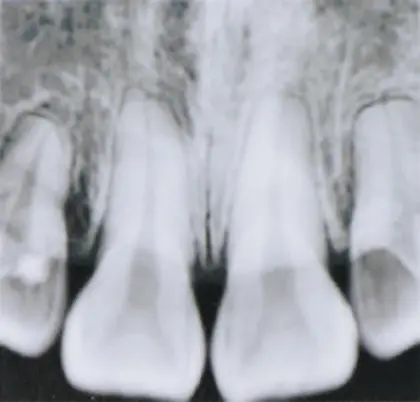 DENTAL X-RAY UNIT