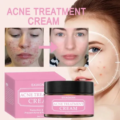 pimple cream for men acne cream