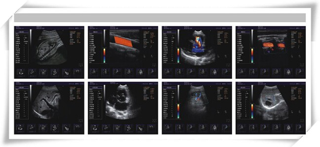 Laptop-Sized Color Doppler Diagnostic System (PRO-CDS800)