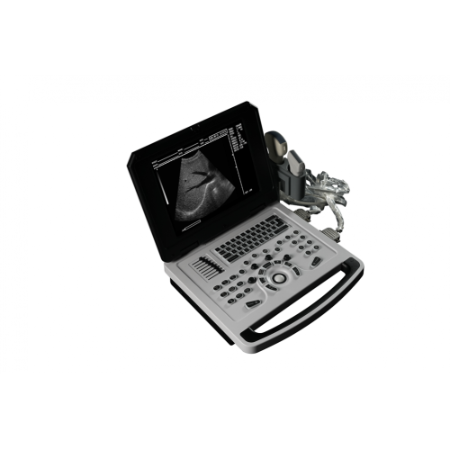 Abdominal Ultrasound Scanner High Quality Notebook B Ultrasound Machine for Abdomen Supplier