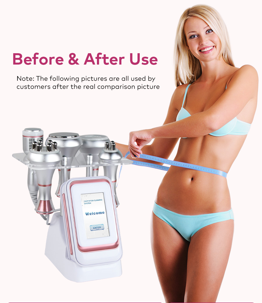cavitation machine for body fat removal