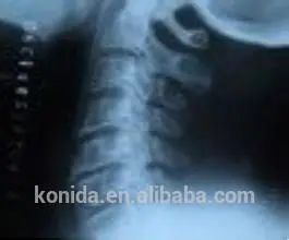 film scanner nayanthara digital camera xray films