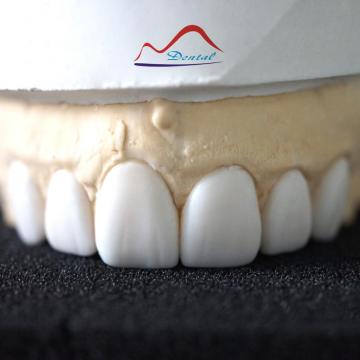 Dental Diagnostic Wax Up