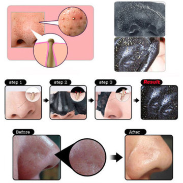 Black Charcoal Pore cleansing and blackhead removal mask for ladies and men