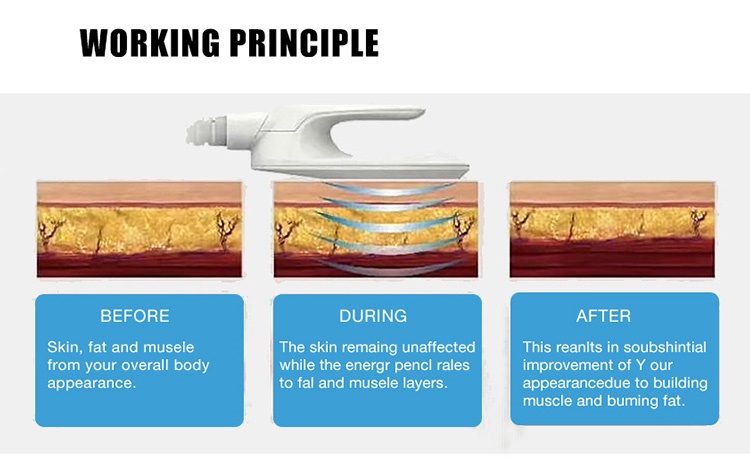 working theory of Muscle Lifting Ems Body Machine