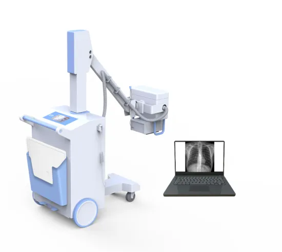 DIGITAL MOBILE X-RAY MACHINE PLX5100