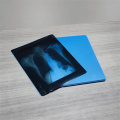 Film Inkjet Silika Powder Blue untuk Output Gambar Medis