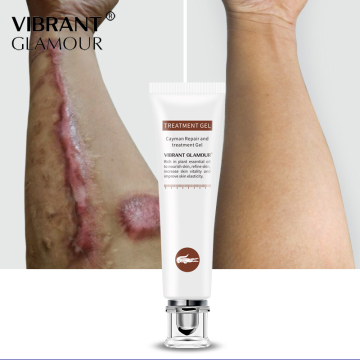 Customize OEM Private Label Acne Scar Removal Gel - Best Selling Whitening Scar Care Gel on Amazon