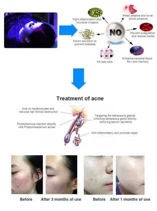 Full Body Davinci Red Light Bed